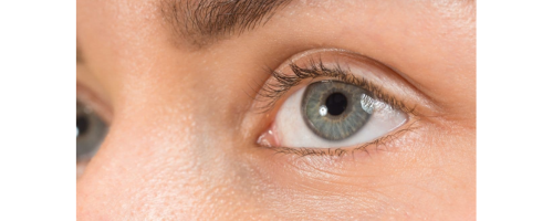 Occhio secco